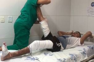 HUT reabilita paciente com 40% do corpo queimado em Teresina (Foto: Divulgação)