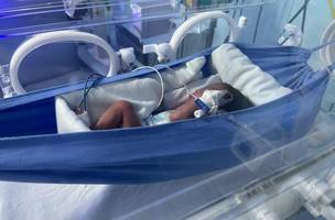 Nova Maternidade usa redinhas para conforto e desenvolvimento de bebês (Foto: Divulgação)