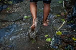 Prefeitura acompanha caso e destaca baixa incidência histórica de leptospirose