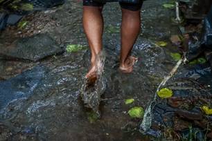 Prefeitura acompanha caso e destaca baixa incidência histórica de leptospirose