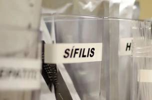 SUS passa a adotar antibiótico para prevenir sífilis e clamídia (Foto: Divulgação)